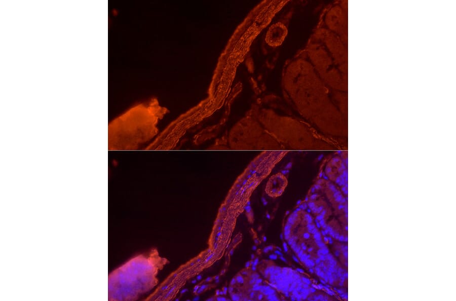 Immunofluorescence - Anti-alpha smooth muscle Actin Antibody (A15615) - Antibodies.com