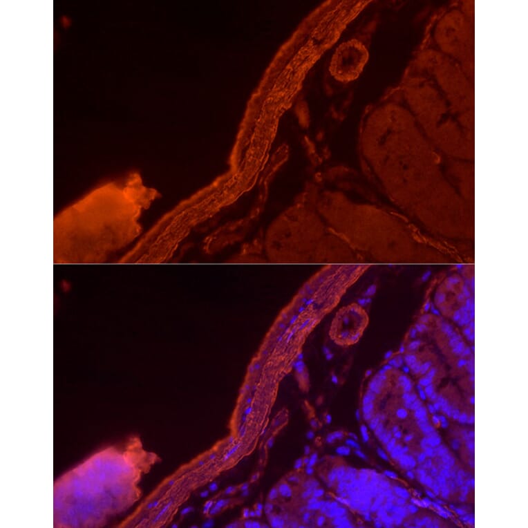 Immunofluorescence - Anti-alpha smooth muscle Actin Antibody (A15615) - Antibodies.com