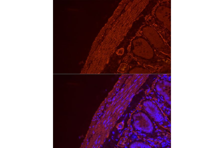 Immunofluorescence - Anti-alpha smooth muscle Actin Antibody (A15615) - Antibodies.com