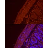 Immunofluorescence - Anti-alpha smooth muscle Actin Antibody (A15615) - Antibodies.com