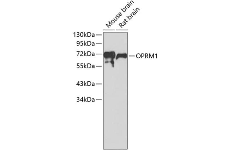 Western Blot - Anti-OPRM1 Antibody (A7264) - Antibodies.com