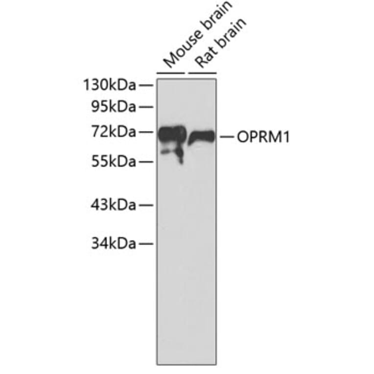Western Blot - Anti-OPRM1 Antibody (A7264) - Antibodies.com