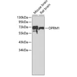 Western Blot - Anti-OPRM1 Antibody (A7264) - Antibodies.com