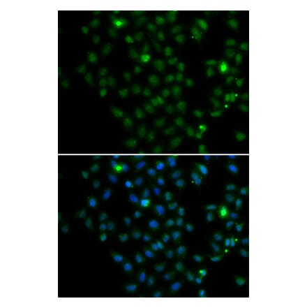 Immunofluorescence - Anti-LMO4 Antibody (A15617) - Antibodies.com