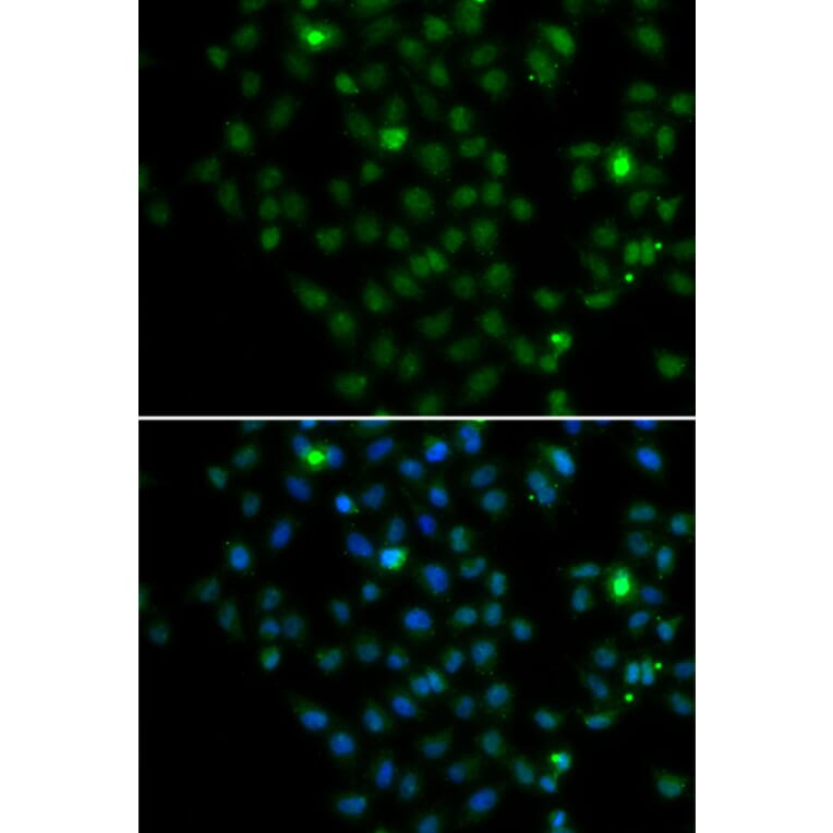 Immunofluorescence - Anti-LMO4 Antibody (A15617) - Antibodies.com