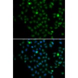 Immunofluorescence - Anti-LMO4 Antibody (A15617) - Antibodies.com