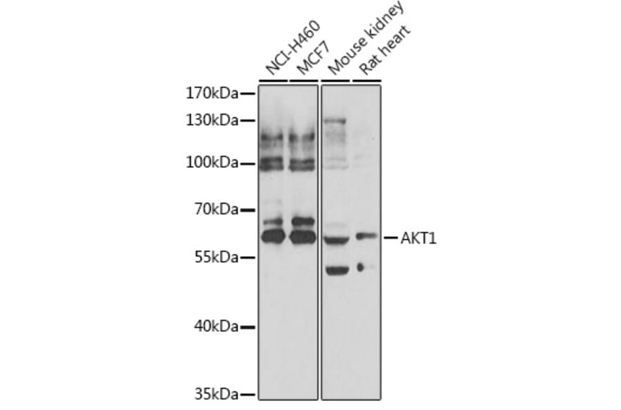 Western Blot - Anti-AKT1 Antibody (A15618) - Antibodies.com