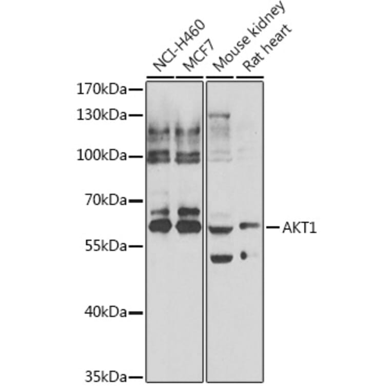 Western Blot - Anti-AKT1 Antibody (A15618) - Antibodies.com