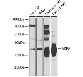 Western Blot - Anti-ASPA Antibody (A15619) - Antibodies.com