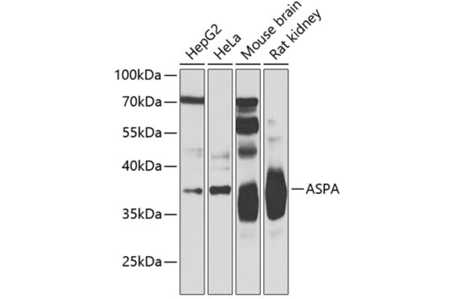 Western Blot - Anti-ASPA Antibody (A15619) - Antibodies.com