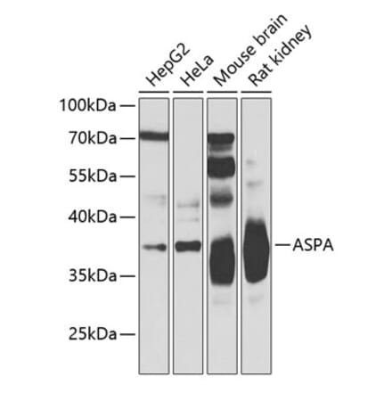 Western Blot - Anti-ASPA Antibody (A15619) - Antibodies.com