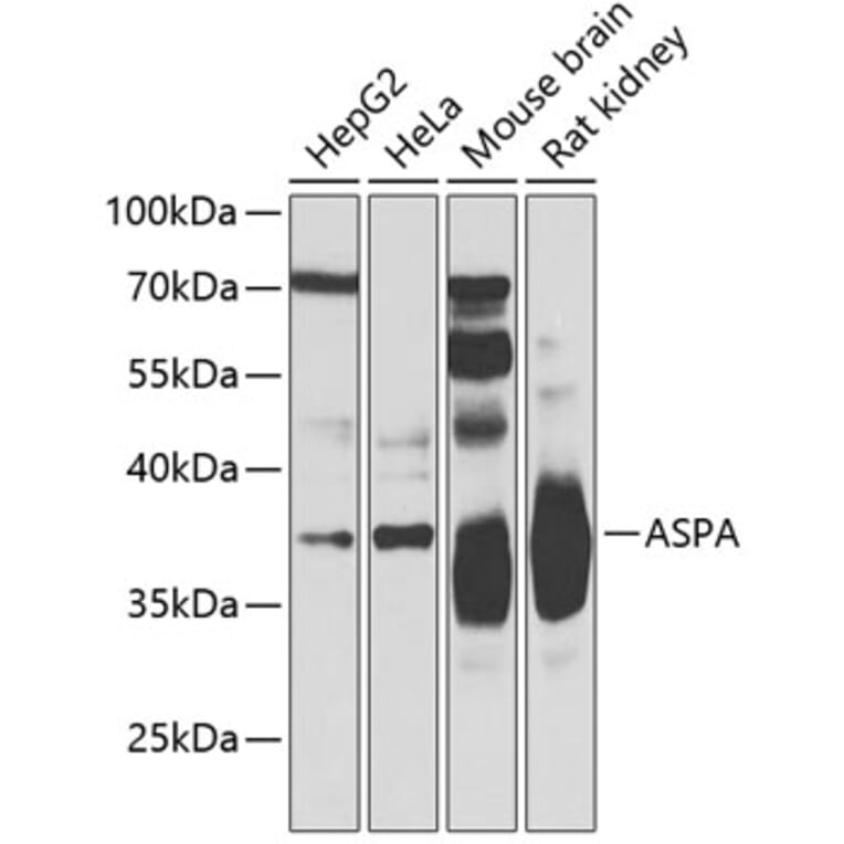 Western Blot - Anti-ASPA Antibody (A15619) - Antibodies.com
