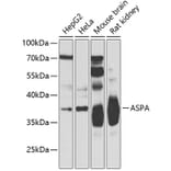 Western Blot - Anti-ASPA Antibody (A15619) - Antibodies.com