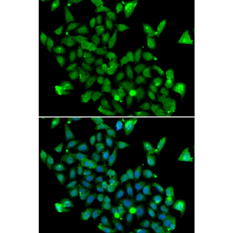 Immunofluorescence - Anti-ASPA Antibody (A15619) - Antibodies.com
