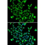 Immunofluorescence - Anti-ASPA Antibody (A15619) - Antibodies.com