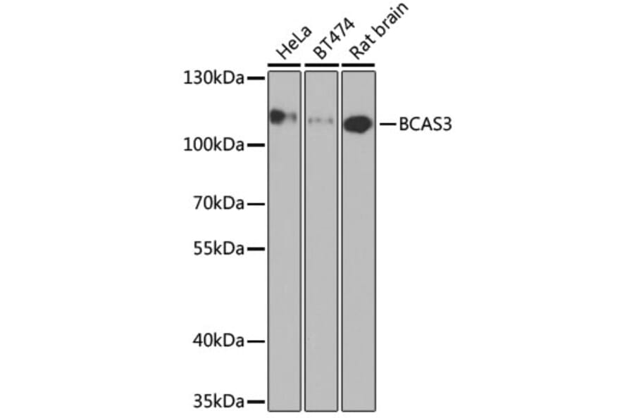 Western Blot - Anti-BCAS3 Antibody (A15620) - Antibodies.com