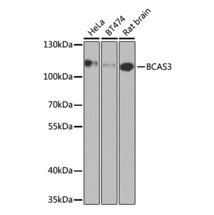 Western Blot - Anti-BCAS3 Antibody (A15620) - Antibodies.com