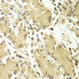 Immunohistochemistry - Anti-BCAS3 Antibody (A15620) - Antibodies.com