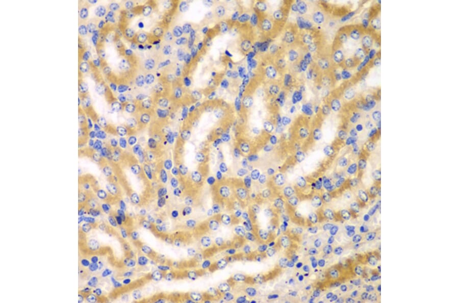 Immunohistochemistry - Anti-BCAS3 Antibody (A15620) - Antibodies.com