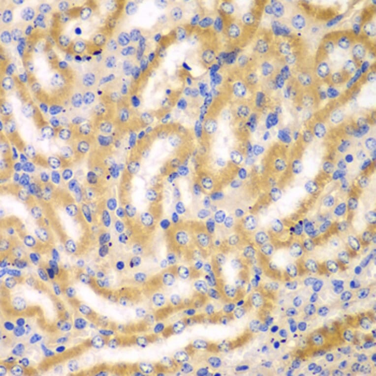 Immunohistochemistry - Anti-BCAS3 Antibody (A15620) - Antibodies.com