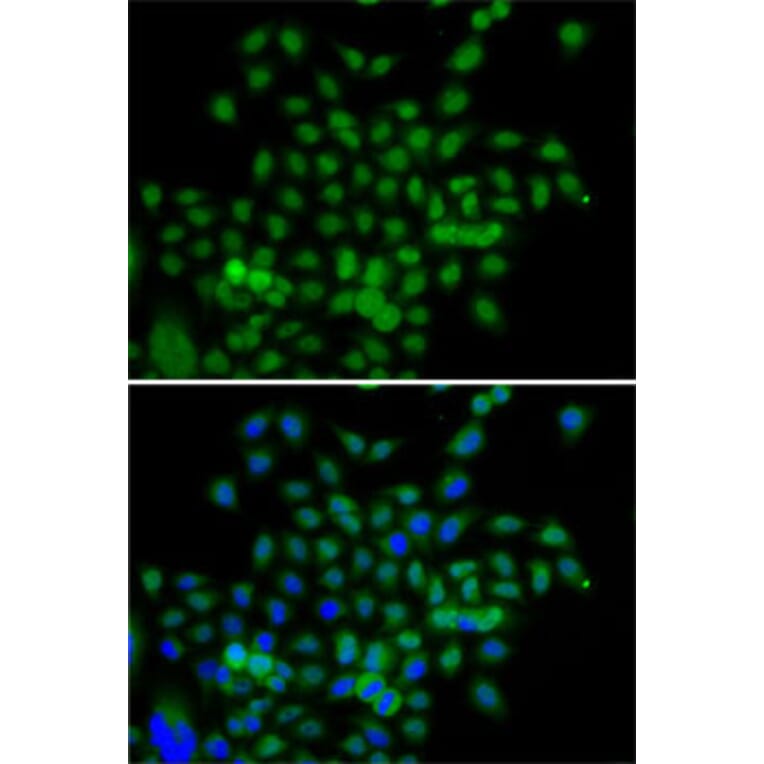 Immunofluorescence - Anti-BCAS3 Antibody (A15620) - Antibodies.com