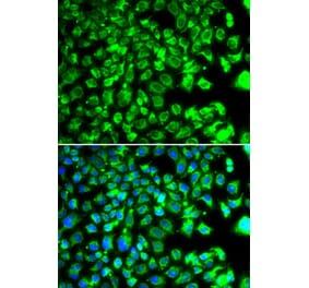 Immunofluorescence - Anti-BORCS7 Antibody (A15621) - Antibodies.com