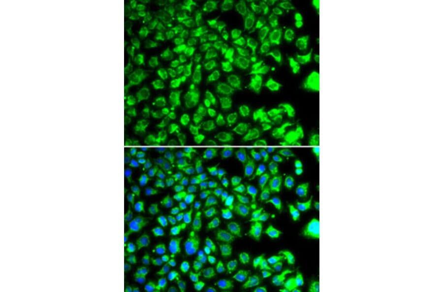 Immunofluorescence - Anti-BORCS7 Antibody (A15621) - Antibodies.com