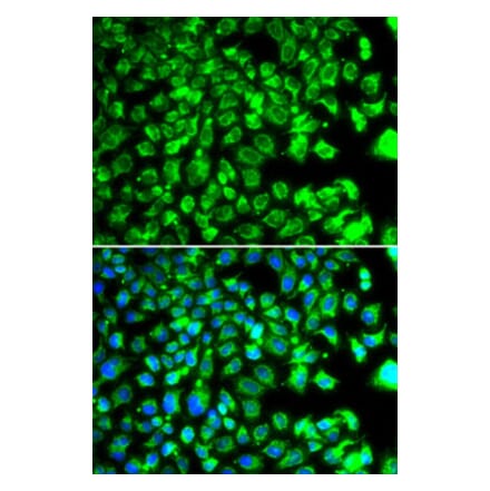 Immunofluorescence - Anti-BORCS7 Antibody (A15621) - Antibodies.com