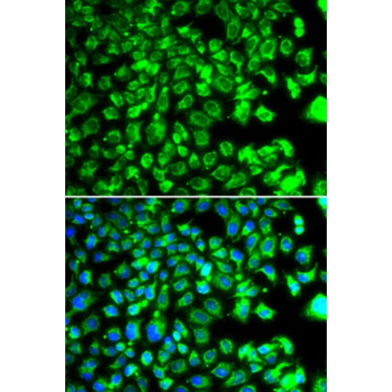 Immunofluorescence - Anti-BORCS7 Antibody (A15621) - Antibodies.com