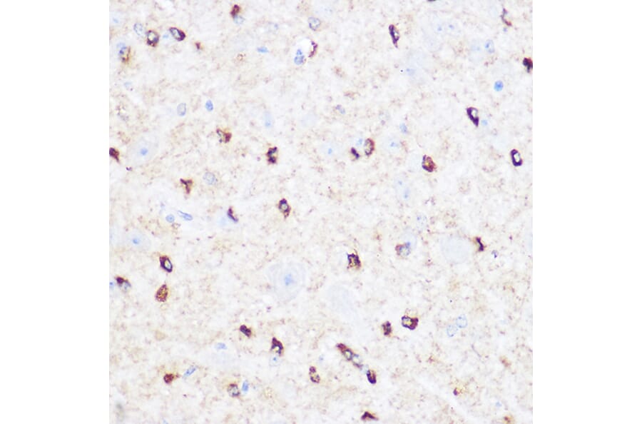 Immunohistochemistry - Anti-CD47 Antibody (A15622) - Antibodies.com