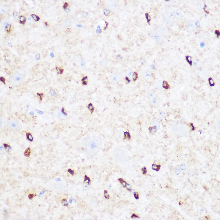 Immunohistochemistry - Anti-CD47 Antibody (A15622) - Antibodies.com