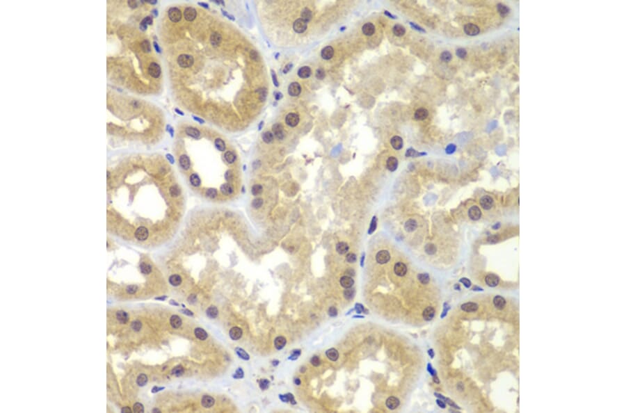 Immunohistochemistry - Anti-CEBPG Antibody (A15623) - Antibodies.com