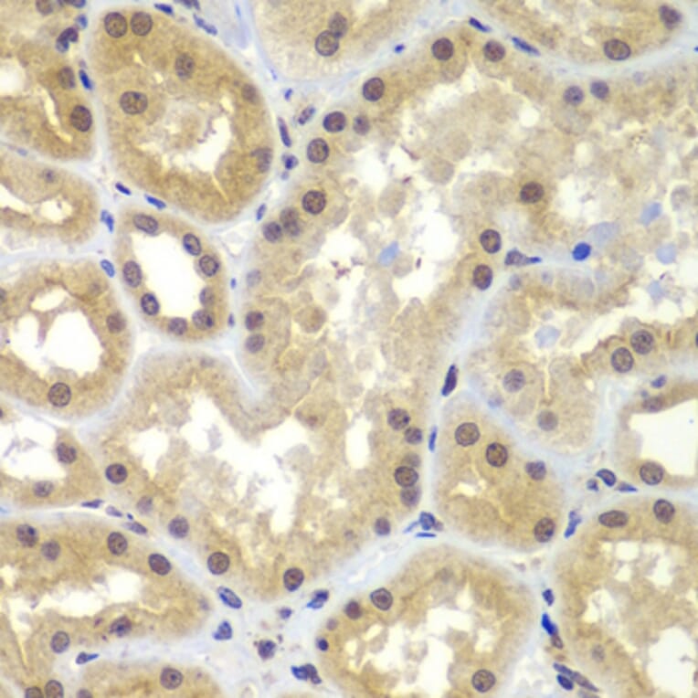Immunohistochemistry - Anti-CEBPG Antibody (A15623) - Antibodies.com