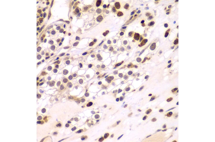 Immunohistochemistry - Anti-CEBPG Antibody (A15623) - Antibodies.com