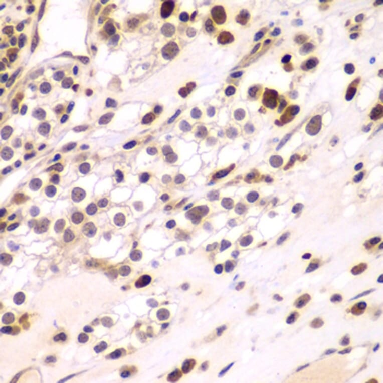 Immunohistochemistry - Anti-CEBPG Antibody (A15623) - Antibodies.com
