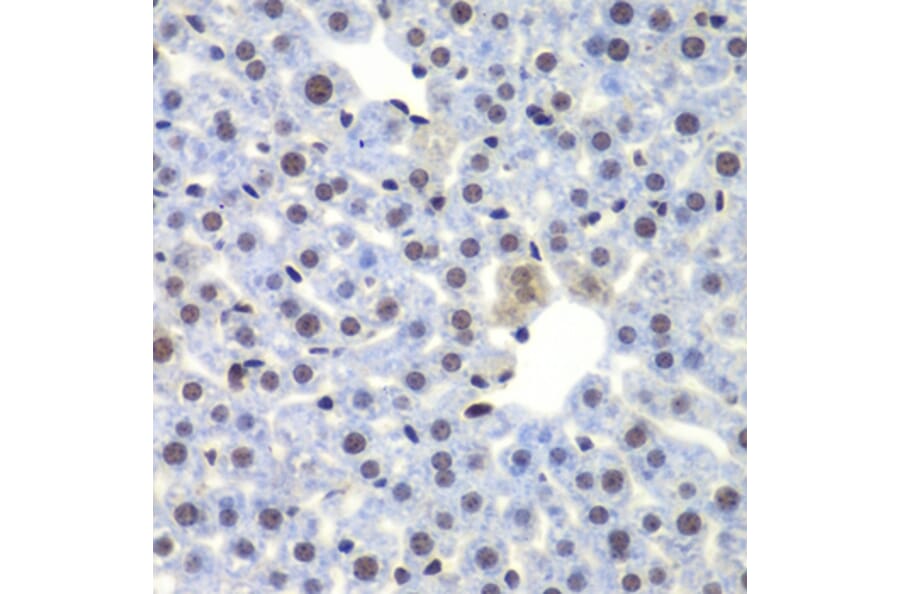 Immunohistochemistry - Anti-CEBPG Antibody (A15623) - Antibodies.com