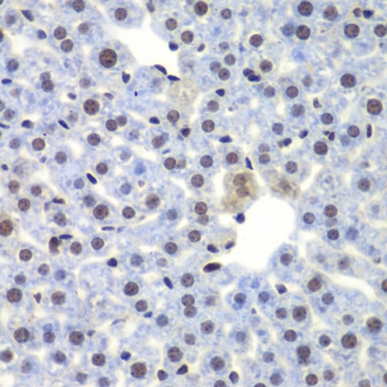 Immunohistochemistry - Anti-CEBPG Antibody (A15623) - Antibodies.com