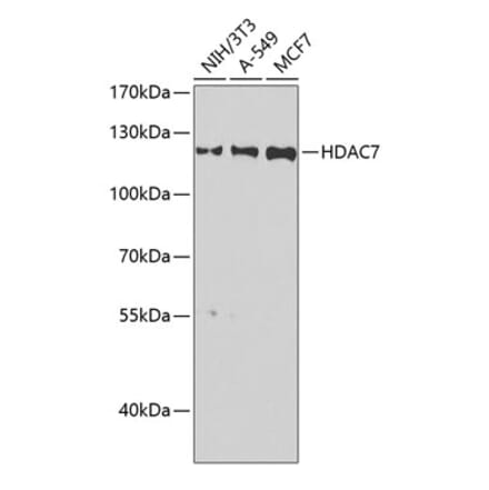 Western Blot - Anti-HDAC7 Antibody (A15625) - Antibodies.com