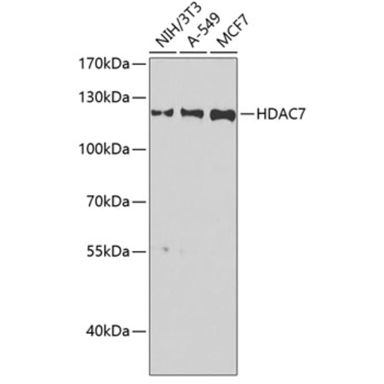 Western Blot - Anti-HDAC7 Antibody (A15625) - Antibodies.com