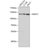 Western Blot - Anti-HDAC7 Antibody (A15625) - Antibodies.com