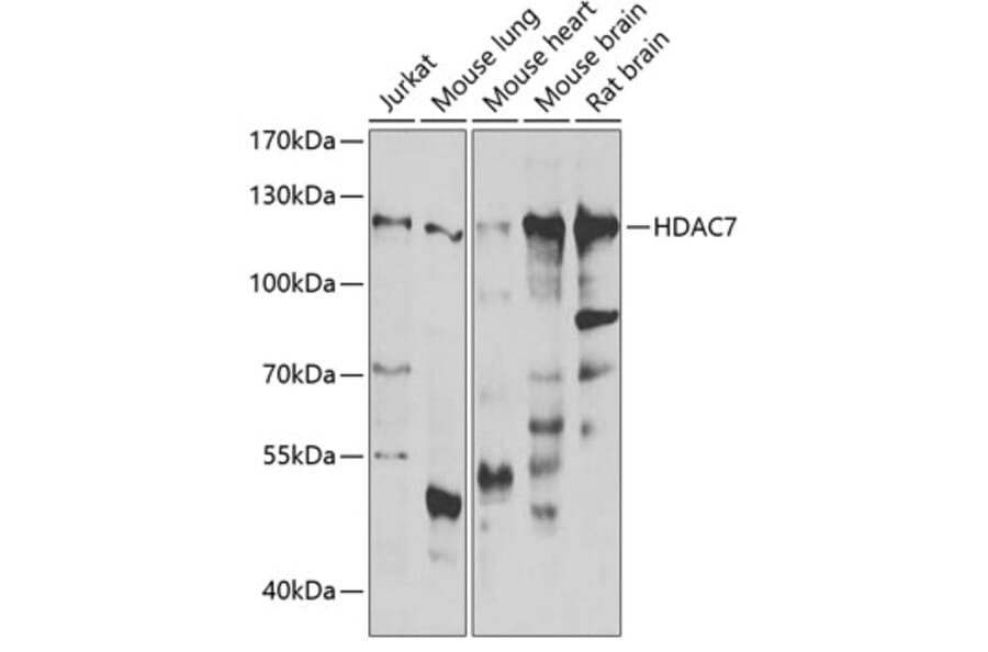 Western Blot - Anti-HDAC7 Antibody (A15625) - Antibodies.com