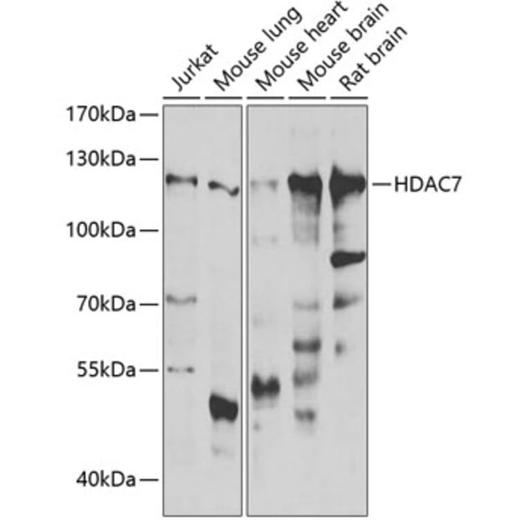 Western Blot - Anti-HDAC7 Antibody (A15625) - Antibodies.com