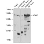 Western Blot - Anti-HDAC7 Antibody (A15625) - Antibodies.com