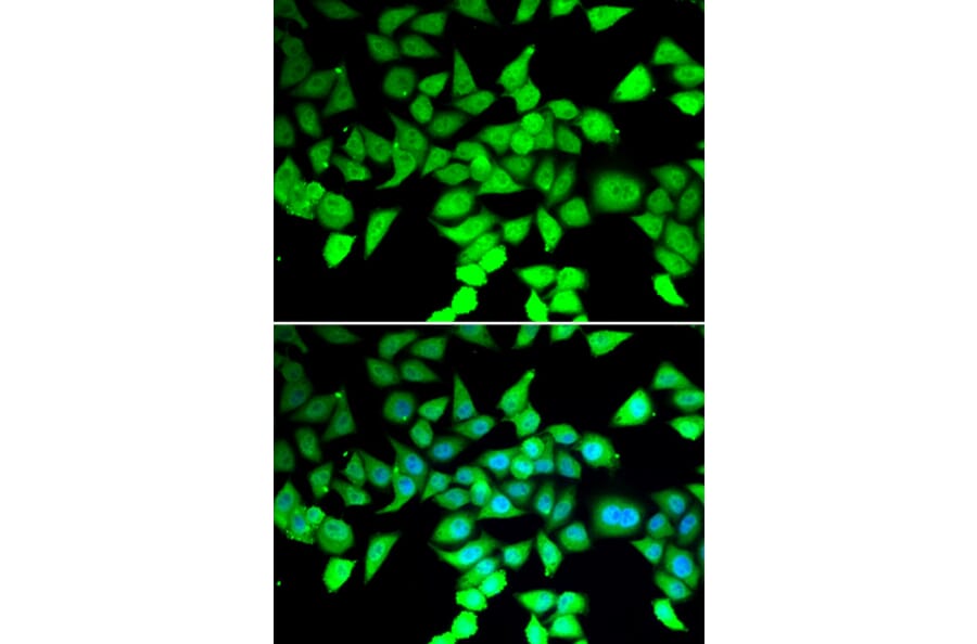 Immunofluorescence - Anti-HDAC7 Antibody (A15625) - Antibodies.com