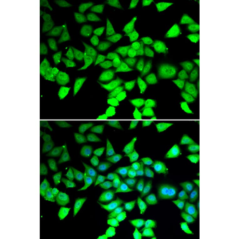 Immunofluorescence - Anti-HDAC7 Antibody (A15625) - Antibodies.com