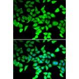 Immunofluorescence - Anti-HDAC7 Antibody (A15625) - Antibodies.com