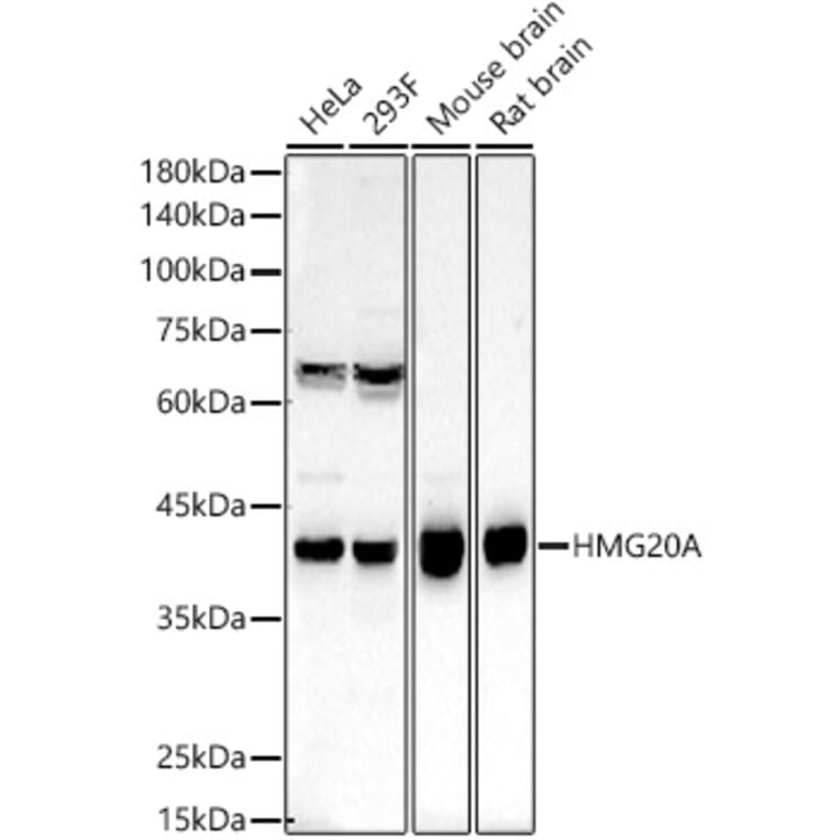 Western Blot - Anti-HMG20A Antibody (A15626) - Antibodies.com
