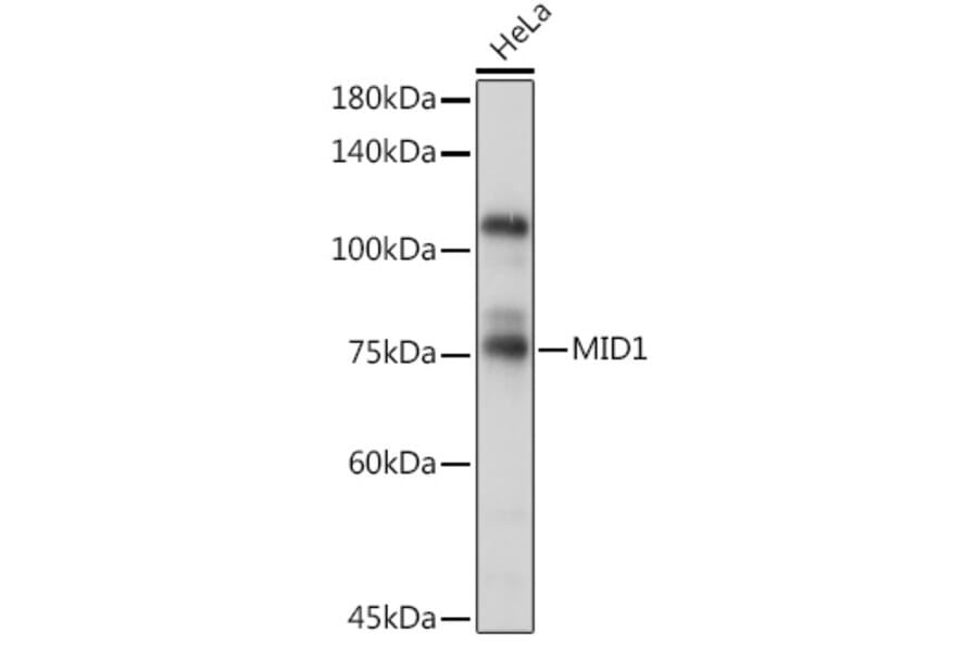 Western Blot - Anti-MID1 Antibody (A15627) - Antibodies.com