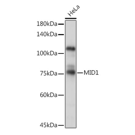Western Blot - Anti-MID1 Antibody (A15627) - Antibodies.com