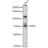 Western Blot - Anti-MID1 Antibody (A15627) - Antibodies.com